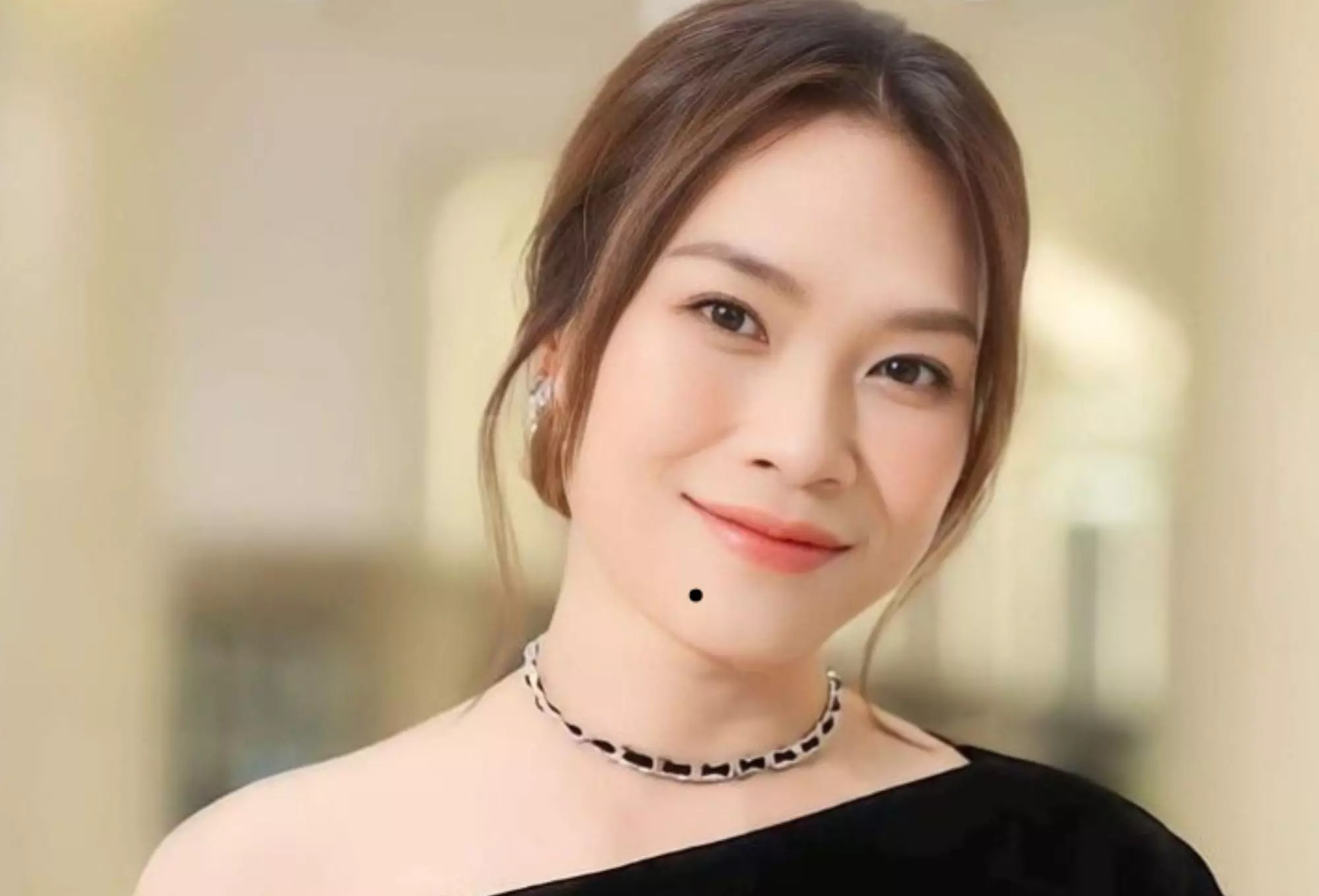 nốt ruồi trên mặt