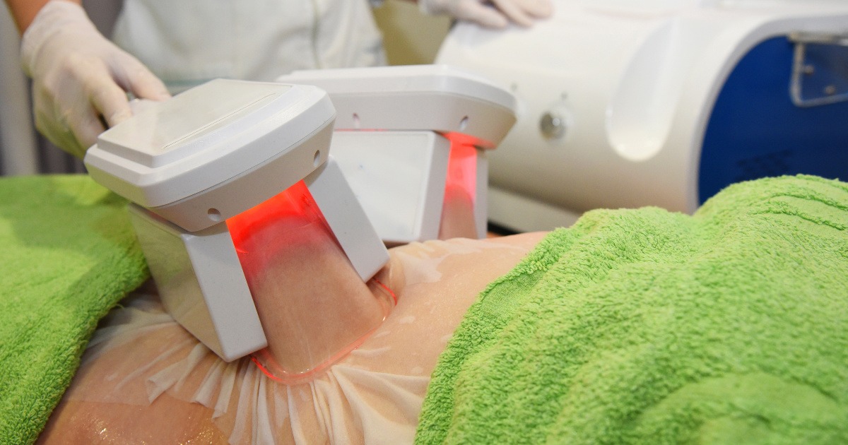 phương pháp điểu trị da sần vỏ cam 