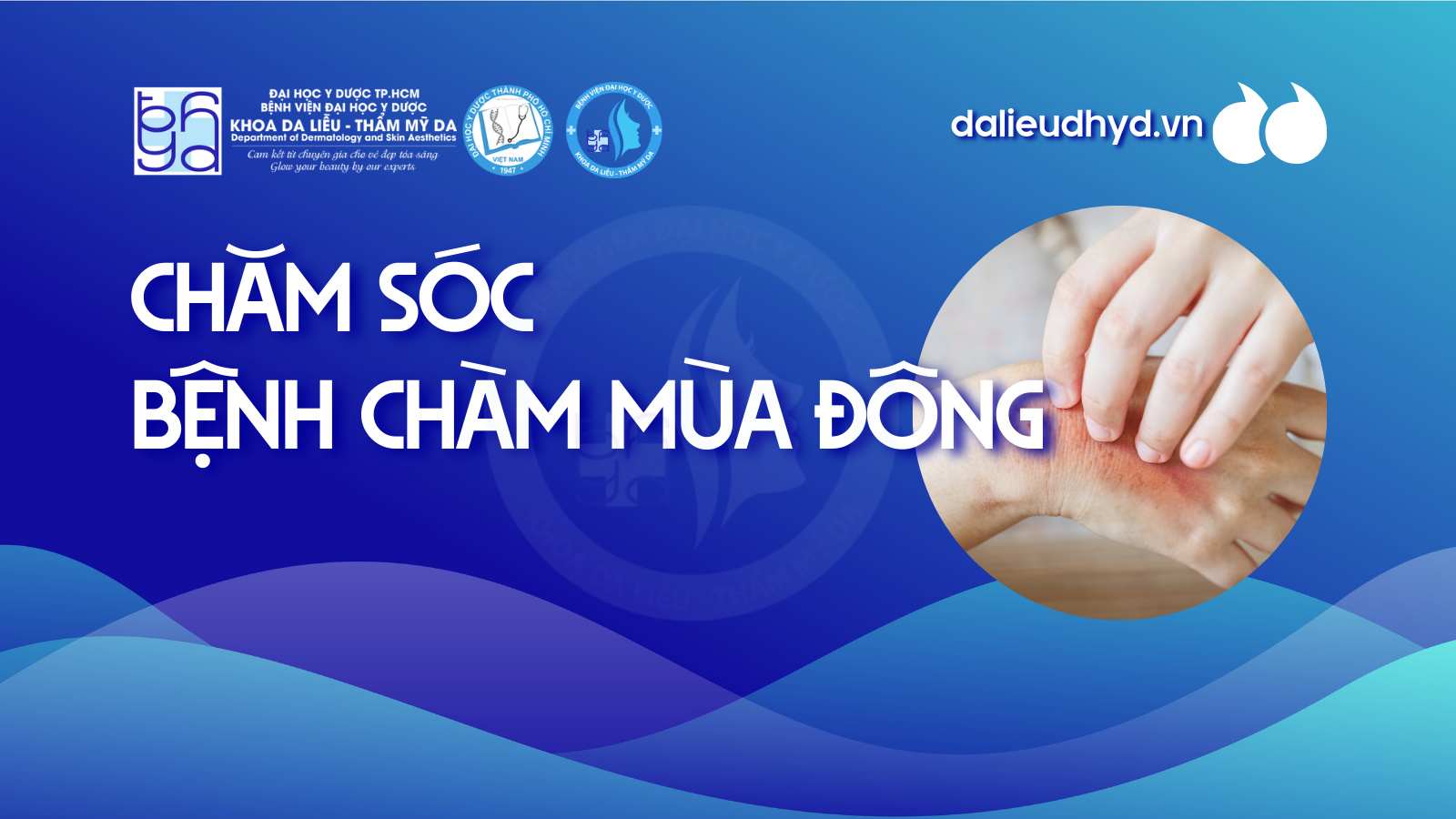 Chăm sóc bệnh chàm mùa đông
