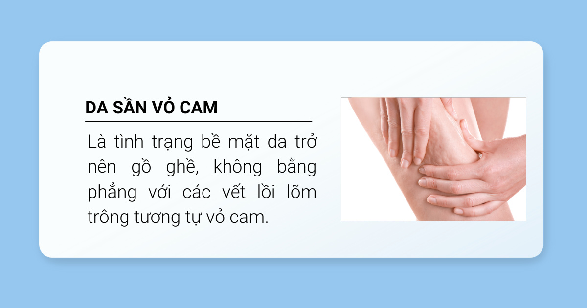 định nghĩa da sần vỏ cam 