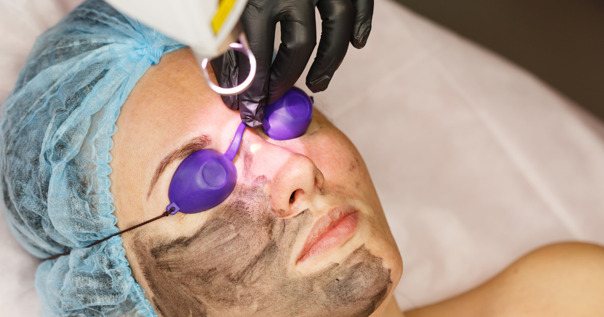 Phương pháp điều trị mụn cứng dưới da hiệu quả và an toàn