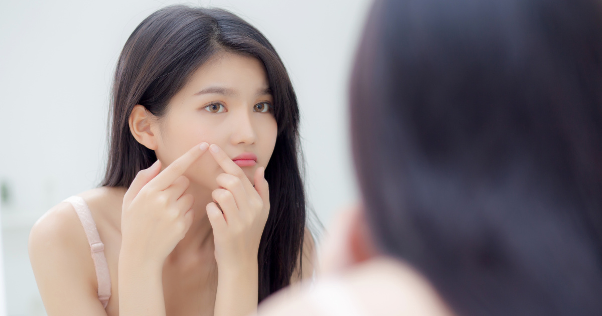 Mụn ẩn ở má phải làm sao