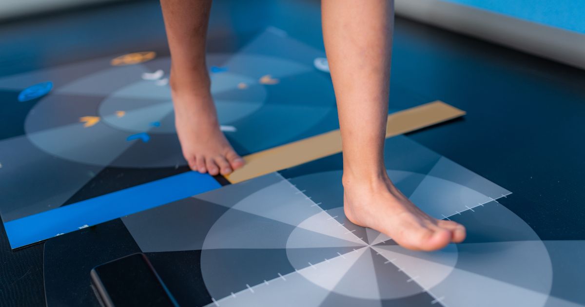 nguyên nhân gây chai chân 