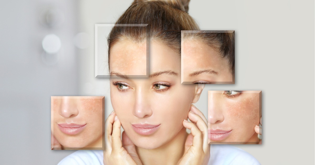 Phản ứng sau khi pee da