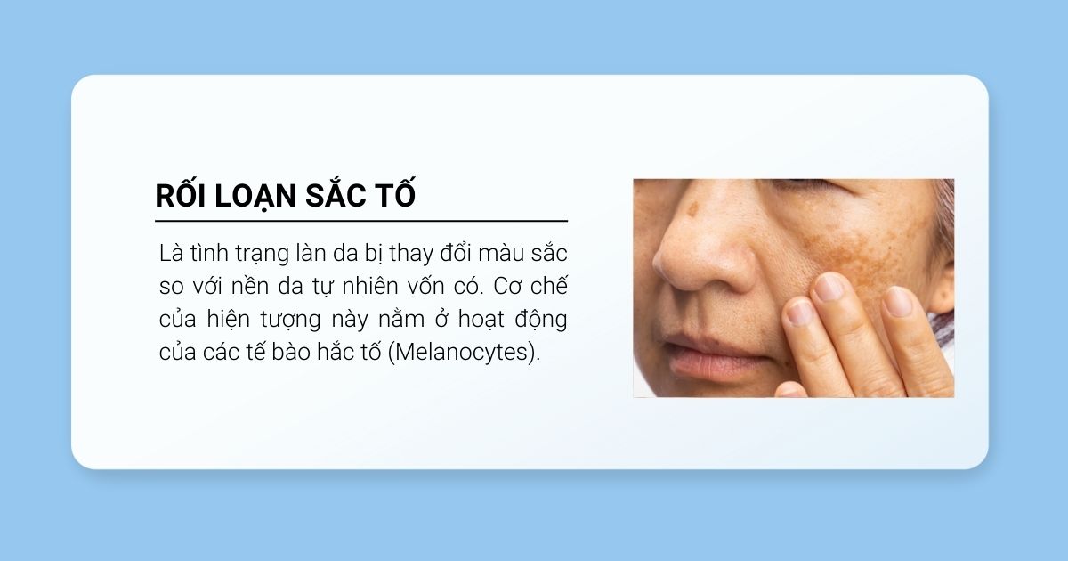 Rối loạn sắc tố là gì