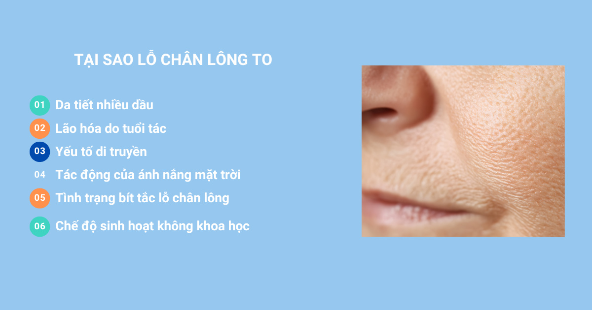 Tại sao lỗ chân lông to