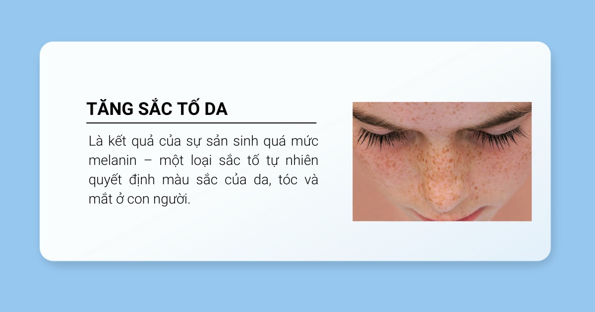 khái niệm tăng sắc tố da