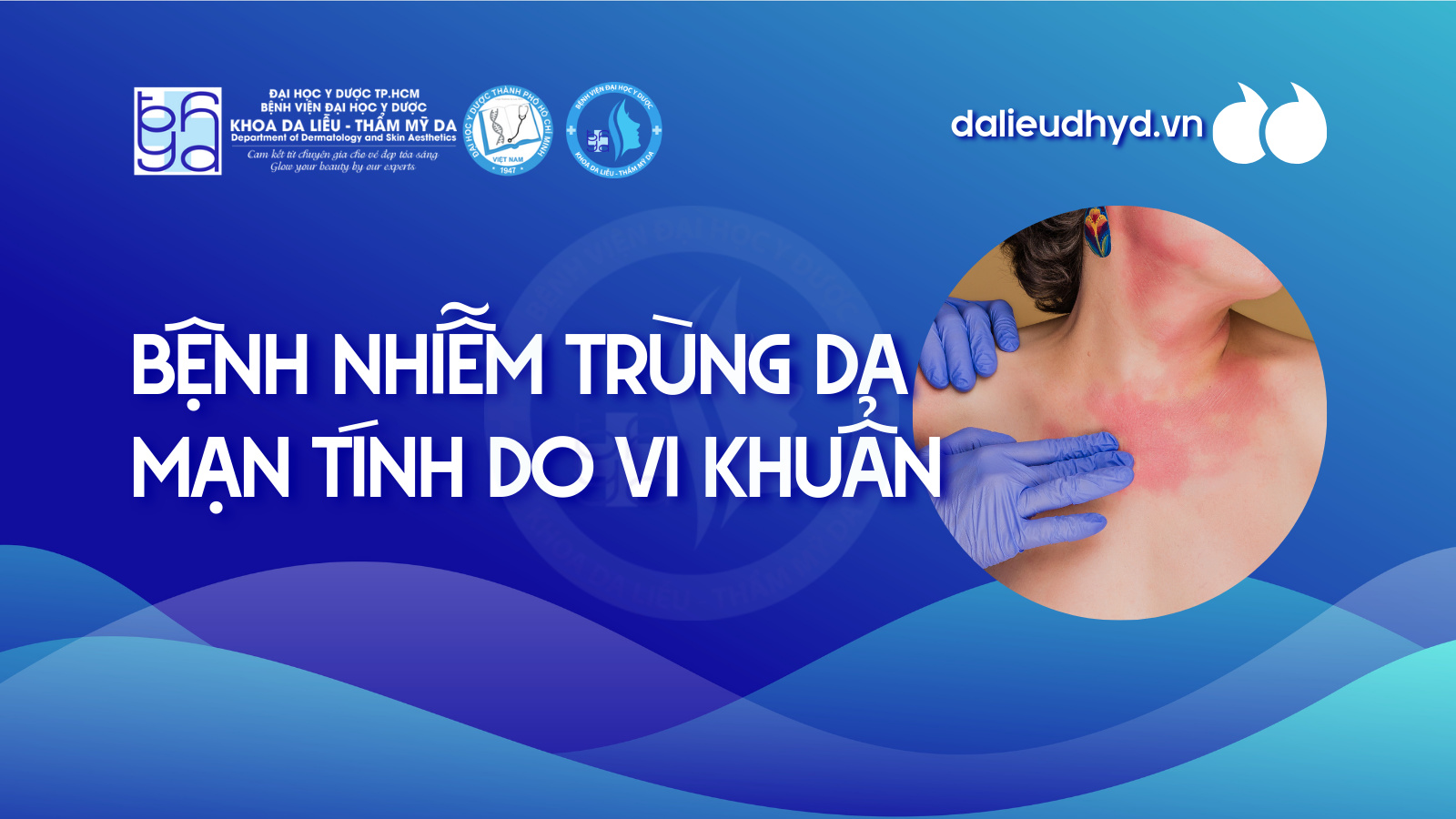 Bệnh nhiễm trùng da mạn tính do vi khuẩn