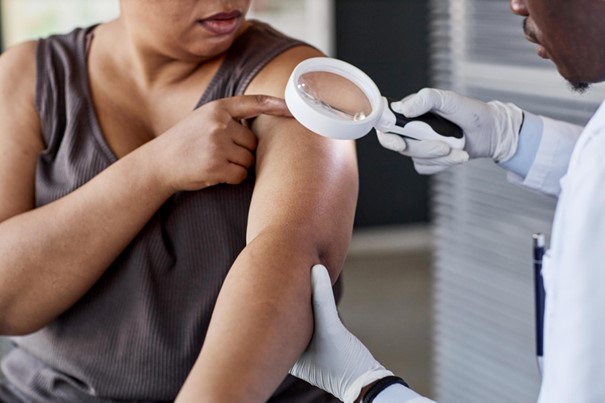 Khám da toàn thân cần thiết là do da phản ánh sức khỏe chung, là ‘hàn thử biểu’ về những bệnh lý nan y (Nguồn: Saucedadermatology) .