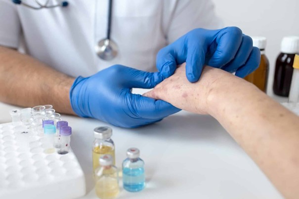 Dị ứng thức ăn, dị ứng da do thức ăn nên duy trì lối sống tích cực và tuân thủ phác đồ điều trị của bác sĩ (Nguồn: Absoluteucare).