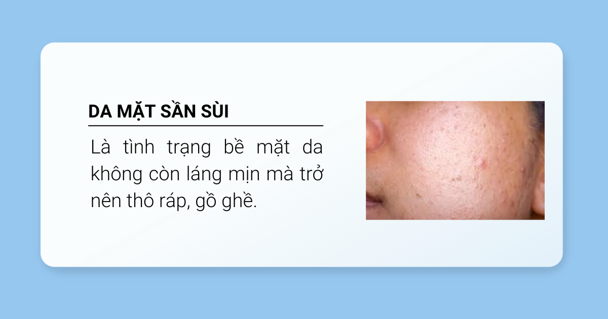 Da mặt sần sùi là gì
