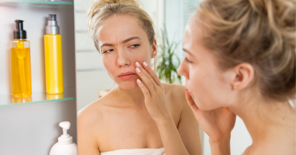 Nguyên nhân da mặt bị sần sùi là gì