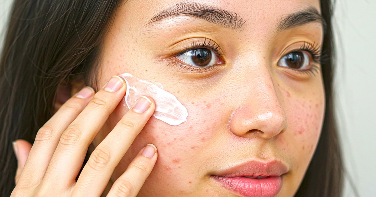 Tại sao lỗ chân lông ngày càng to?